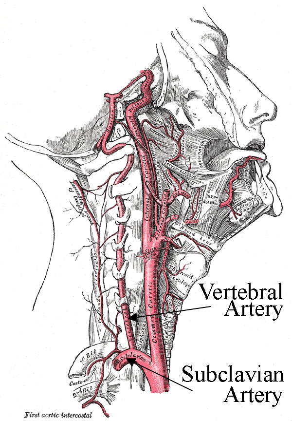 vertebral arteries